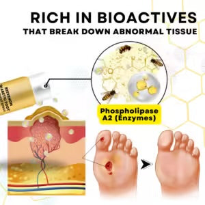 BeeVenom Diabetic Foot Treatment Spray